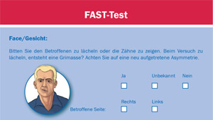 FAST-Test zur Erkennung von Schlaganfallsymptomen