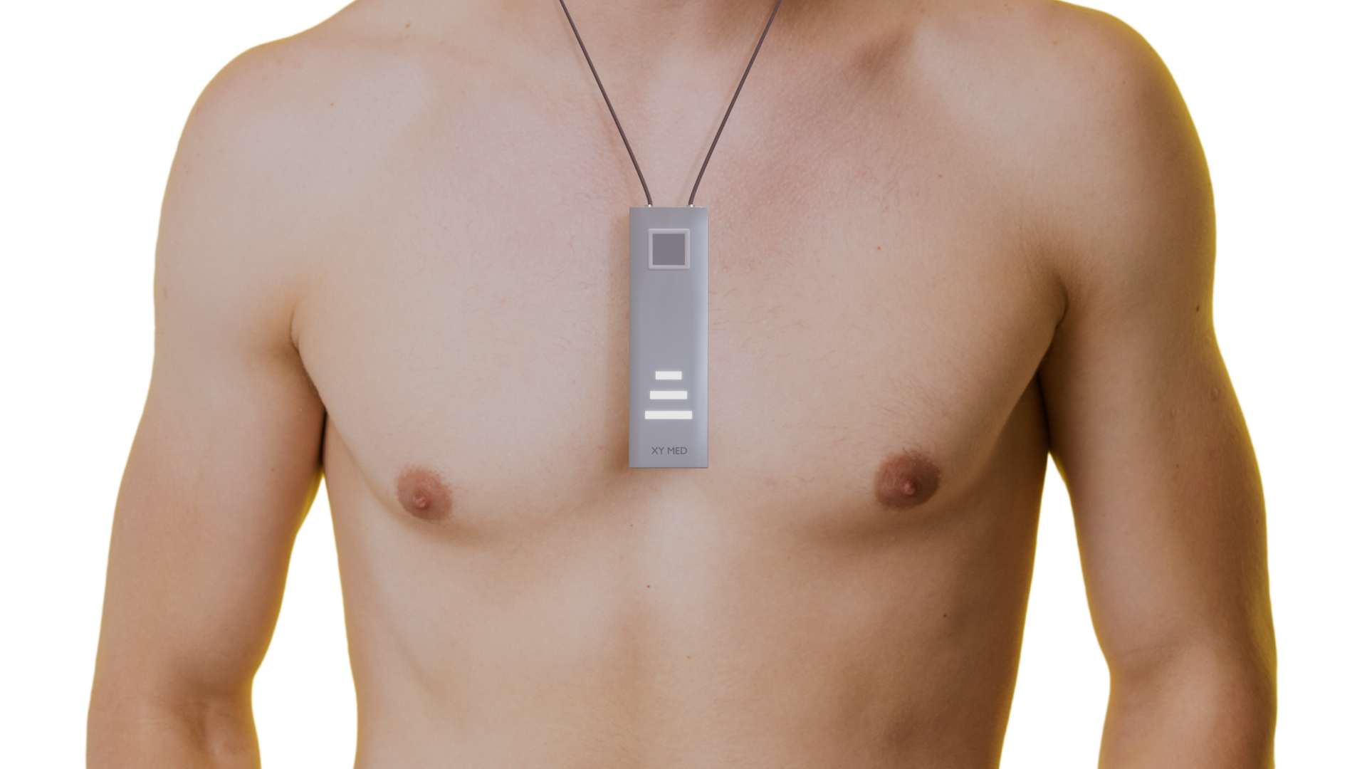 Tele-ekg
