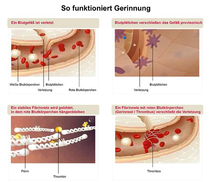 Normale Blutgerinnung