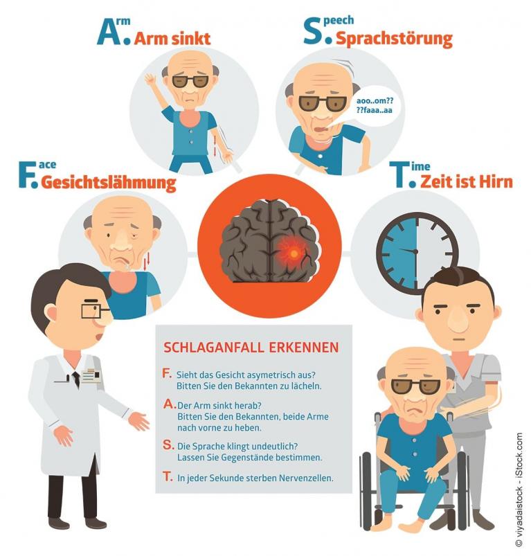 Schlaganfall erkennen